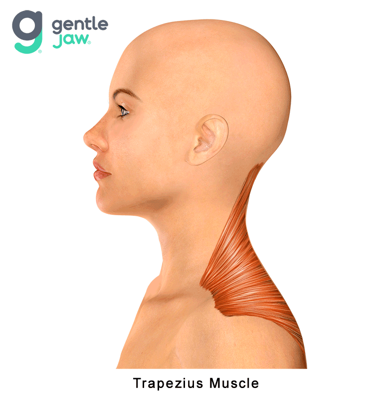 Muscle-Referral-Patterns-Trapezius.gif